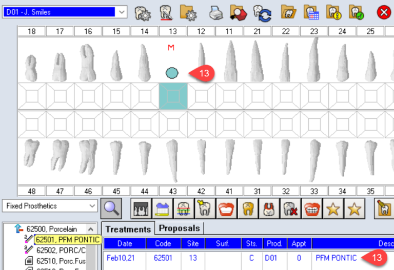 How to Enter a Pontic on the Odontogram Power Practice